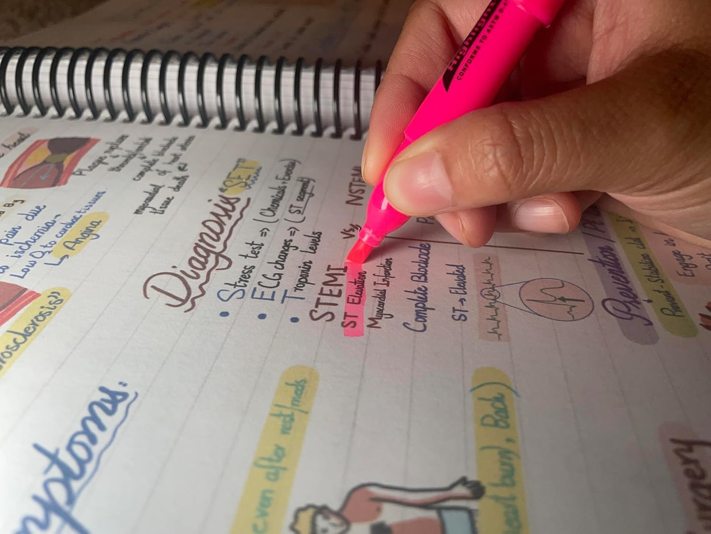 Nursing Mastery Notes™