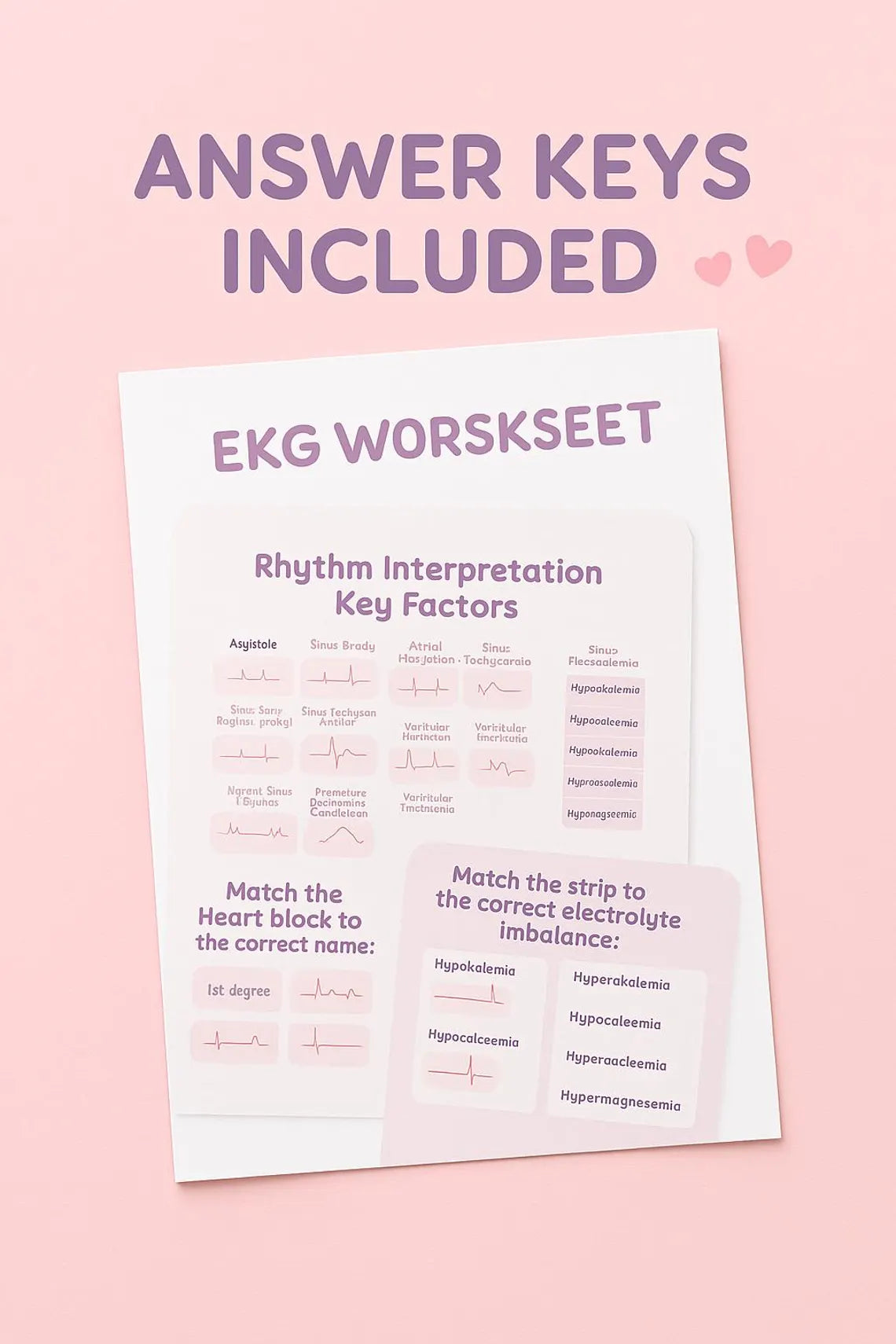 EKG Study Guide Worksheet | Nursing School ECG Rhythm Practice (PDF) Free